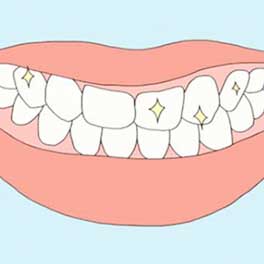 Does sodium monofluorophosphate whiten teeth?