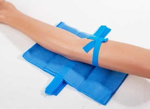 photo of hemostatic material