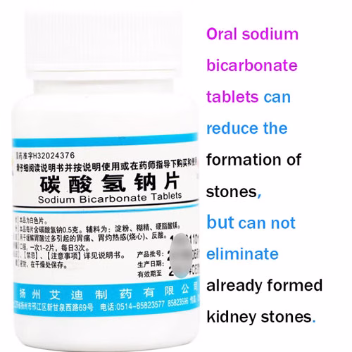 sodium bicarbonat can gradually reduce the size of the stones