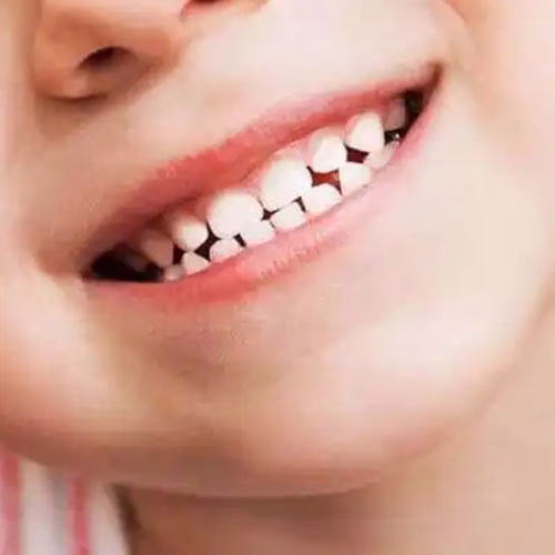 Can xylitol grow back gums